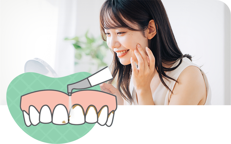 予防歯科・定期検診